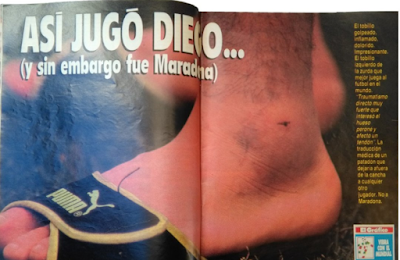 Me acordé de aquel tobillo de maradona
