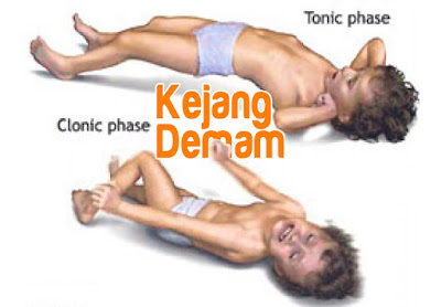  Anak Kejang Demam