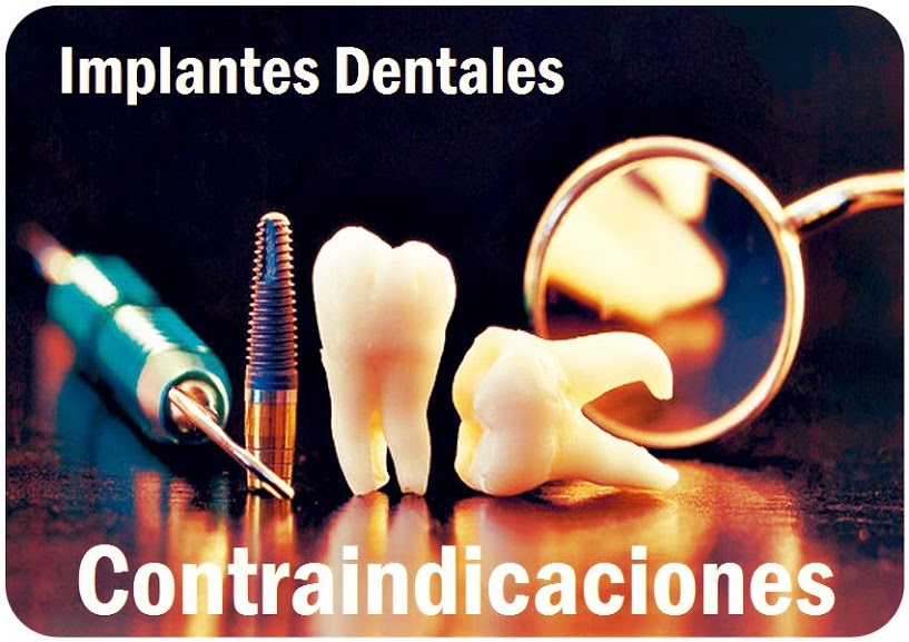 IMPLANTOLOGÍA Contraindicaciones para la colocación de implantes dentales