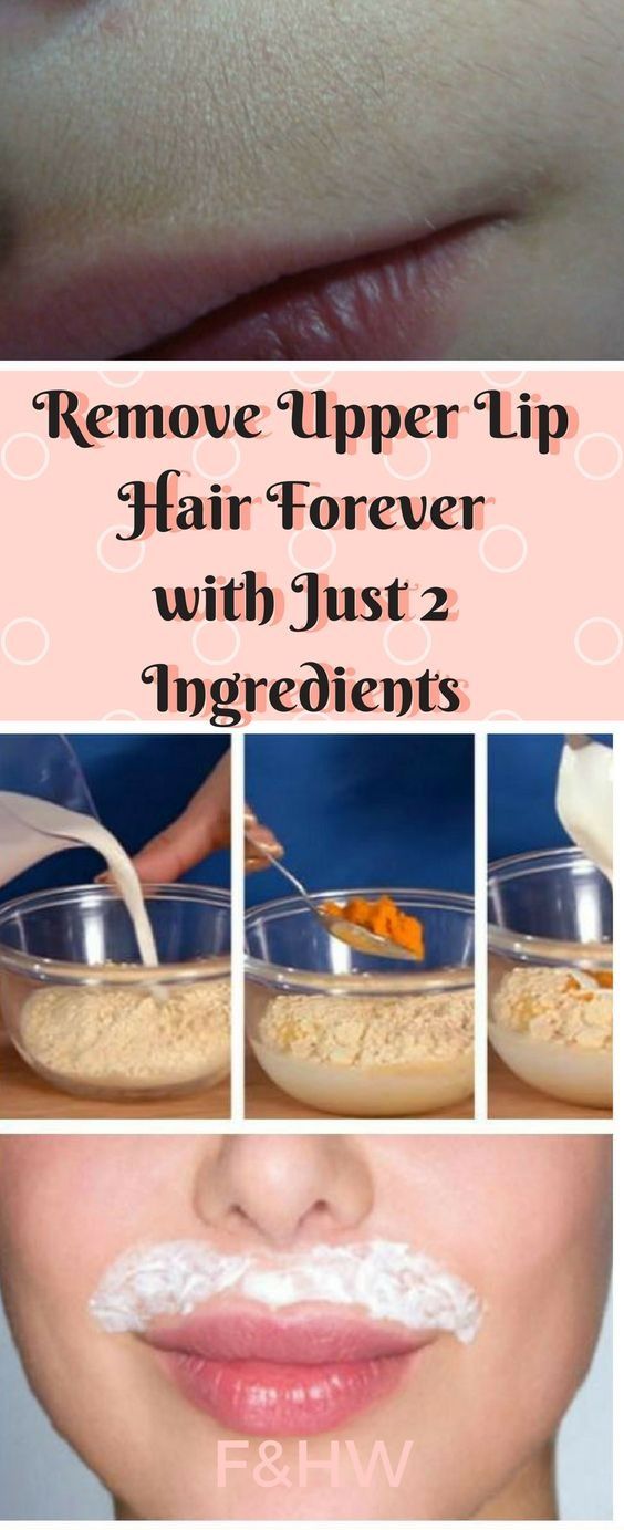 REMOVE UPPER LIP HAIR FOREVER WITH JUST 2 INGREDIENTS Health Fitness