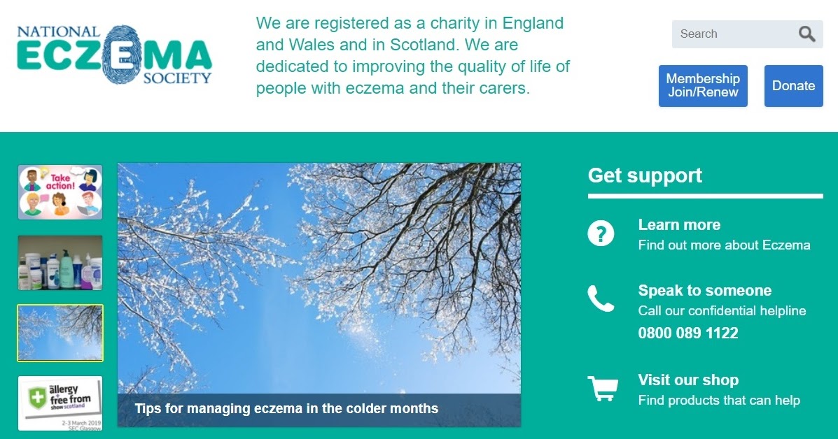 National Eczema Week September 2013 1 in 12 adults suffer from eczema