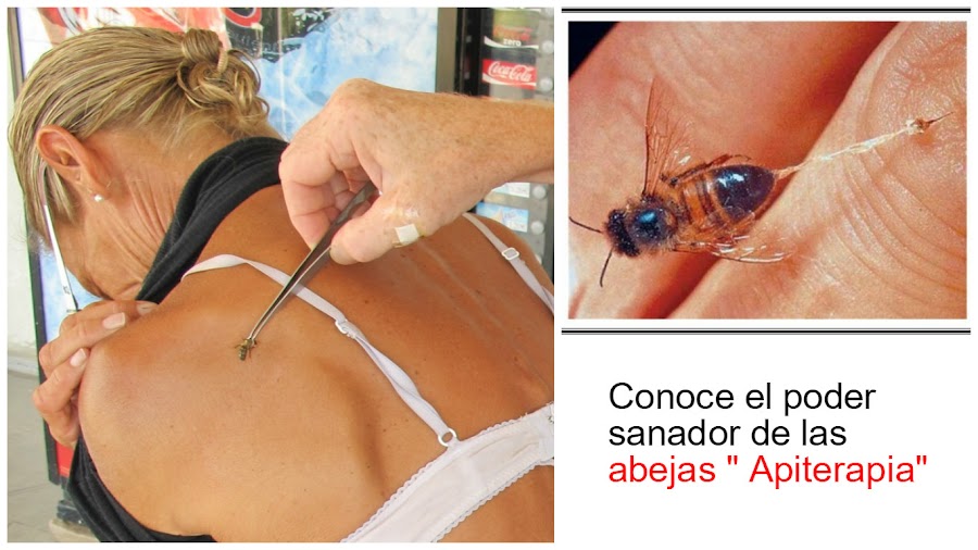enfermedades-curadas-con-abejas-apiterapia