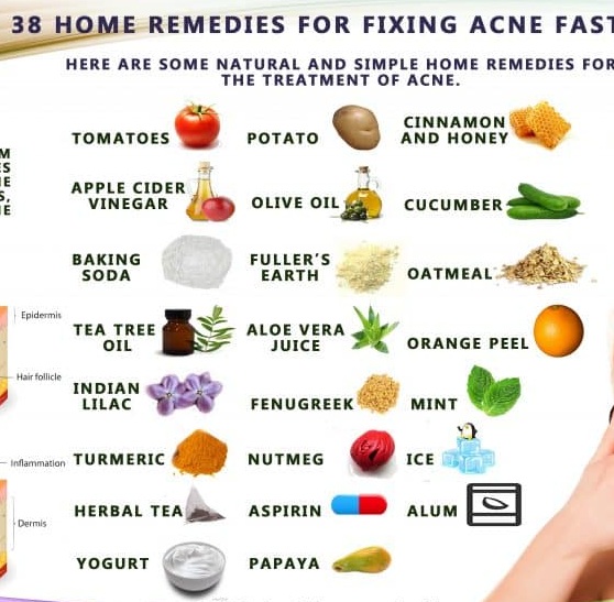 Adult Acne Solutions and Home Remedies - Feedtheking