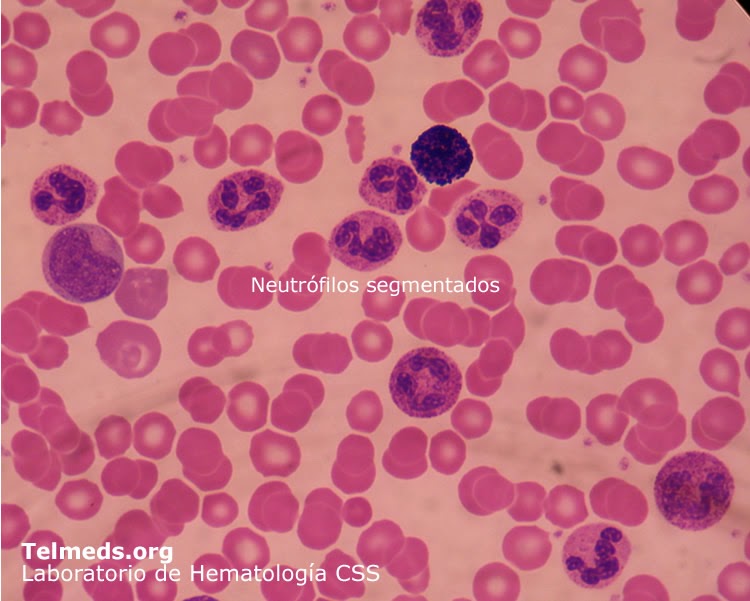 Hematologia Serie Leucocitaria, neutrofilos Hematologia Serie Leucocitaria, neutrofilos
