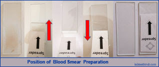 Position of blood smear preparation
