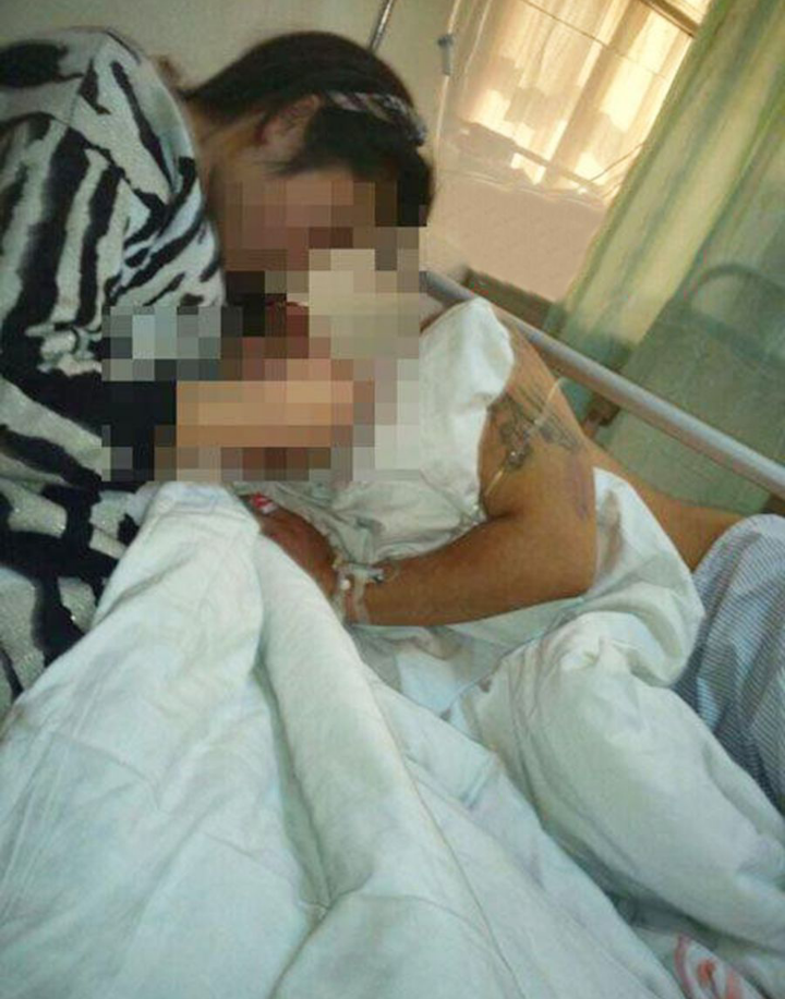 Angry wife snipped off husband's manhood twice.