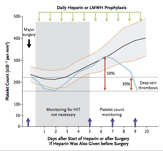 Manuali di Medicina Intensiva: Heparin Induces Thrombocytopenia - HIT ...
