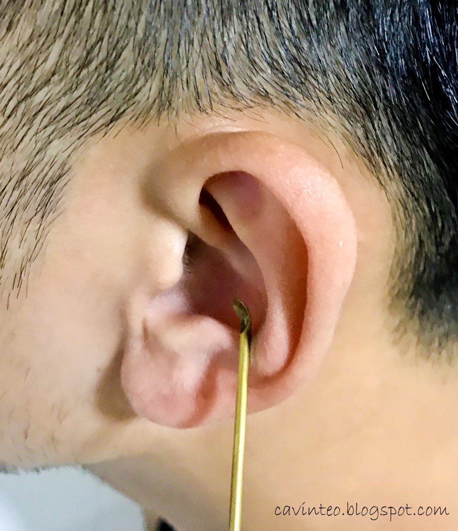 Entree Kibbles Ear Wax Removal The Western Medical Way