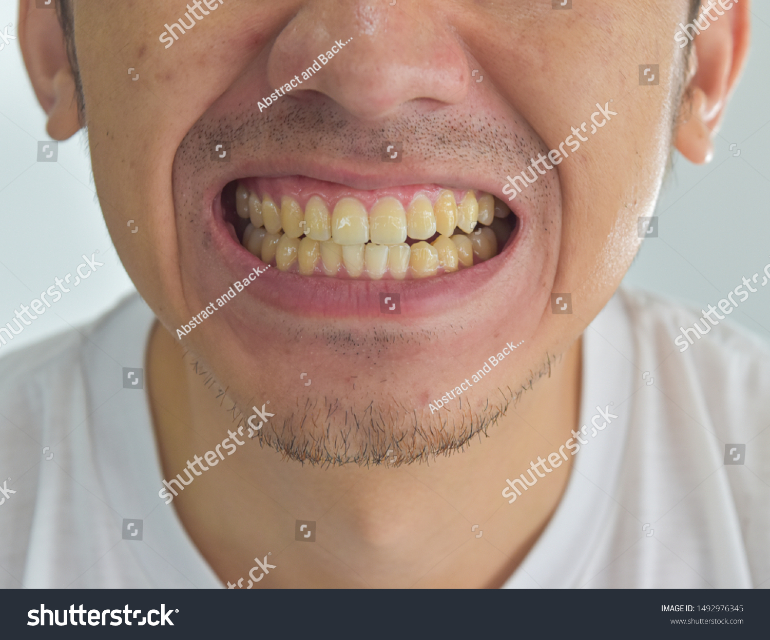 К чему снится что ломается зуб. Желтые зубы во сне. Желтые зубы во сне. Цветные зубы. Цветные зубы.