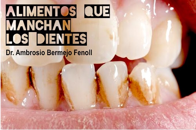 ENTREVISTA: Alimentos que manchan los dientes - Dr. Ambrosio Bermejo 