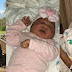 Young woman born with facial deformity writes as she welcomes a beautiful baby girl