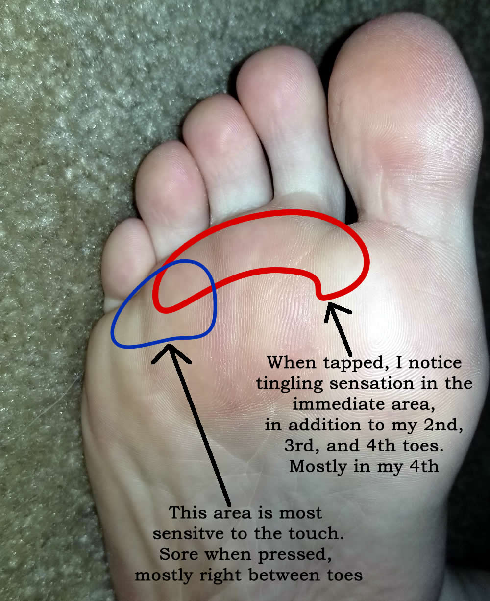 Foot and Ankle Problems By Dr. Richard Blake September 2018