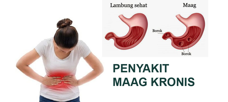 Maag это бывший. Maag zara. Maag это бывший. Maag логотип. Maag лого.