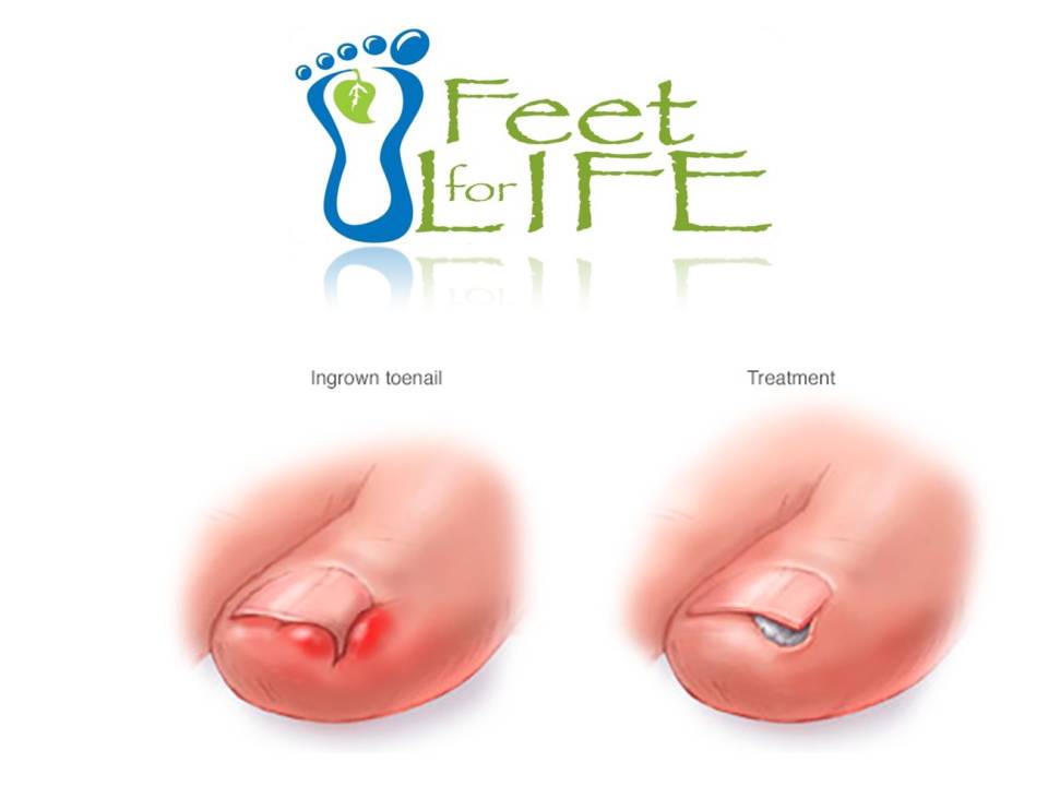 Feet For Life Medical Foot Care Ltd Foot Care Medical clinic in Barrie