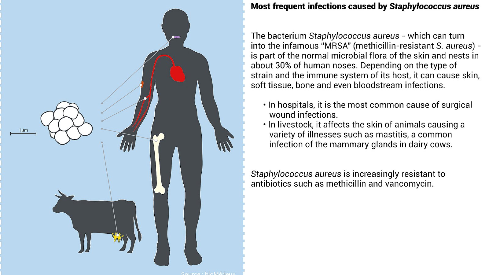 Mrsa Infections Are Most Commonly Spread By - Spread Choices