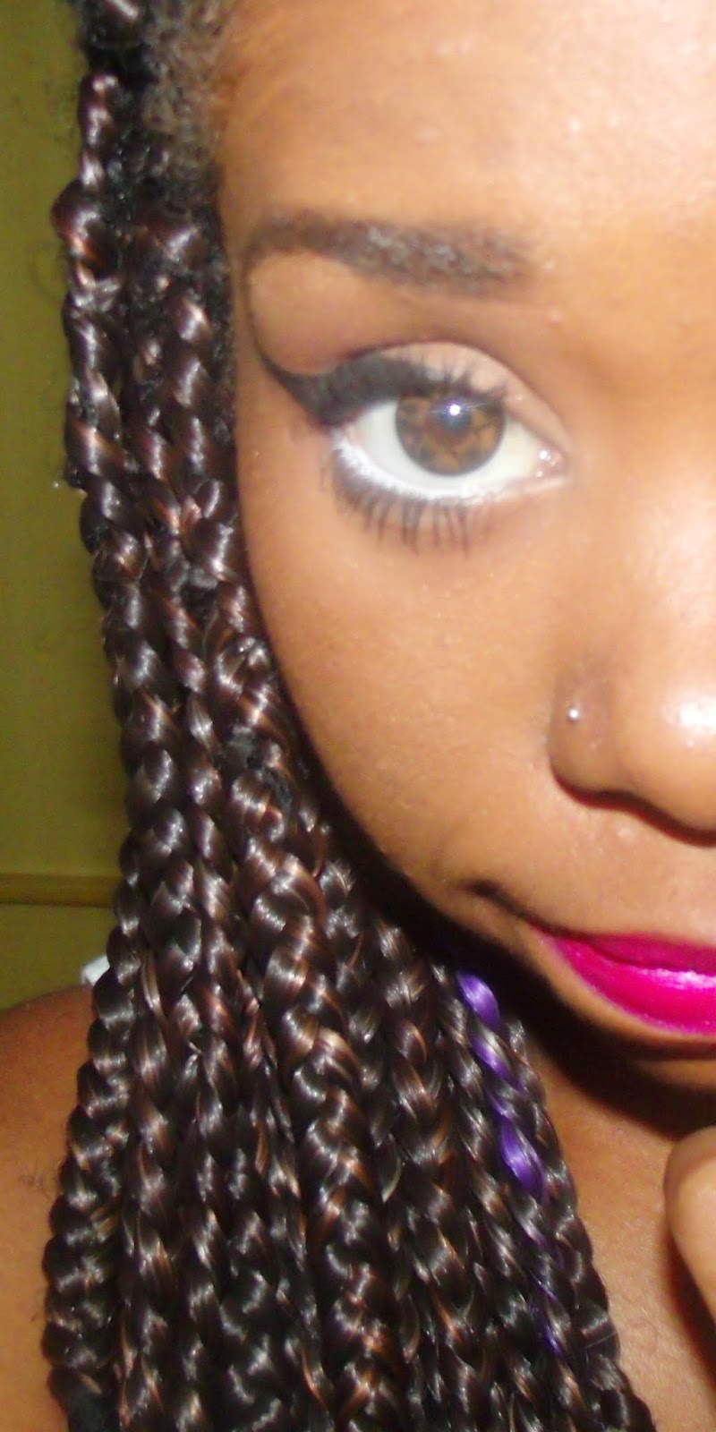 Laços & Gatos Deu queloide, e agora?