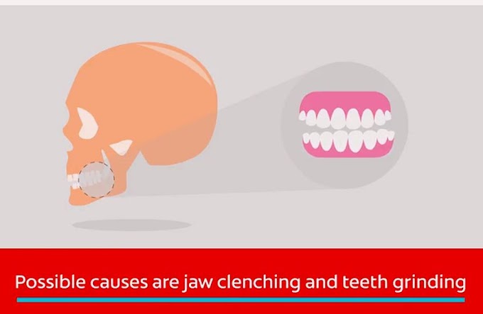 What is TMJ? The Causes of your Jaw Pain