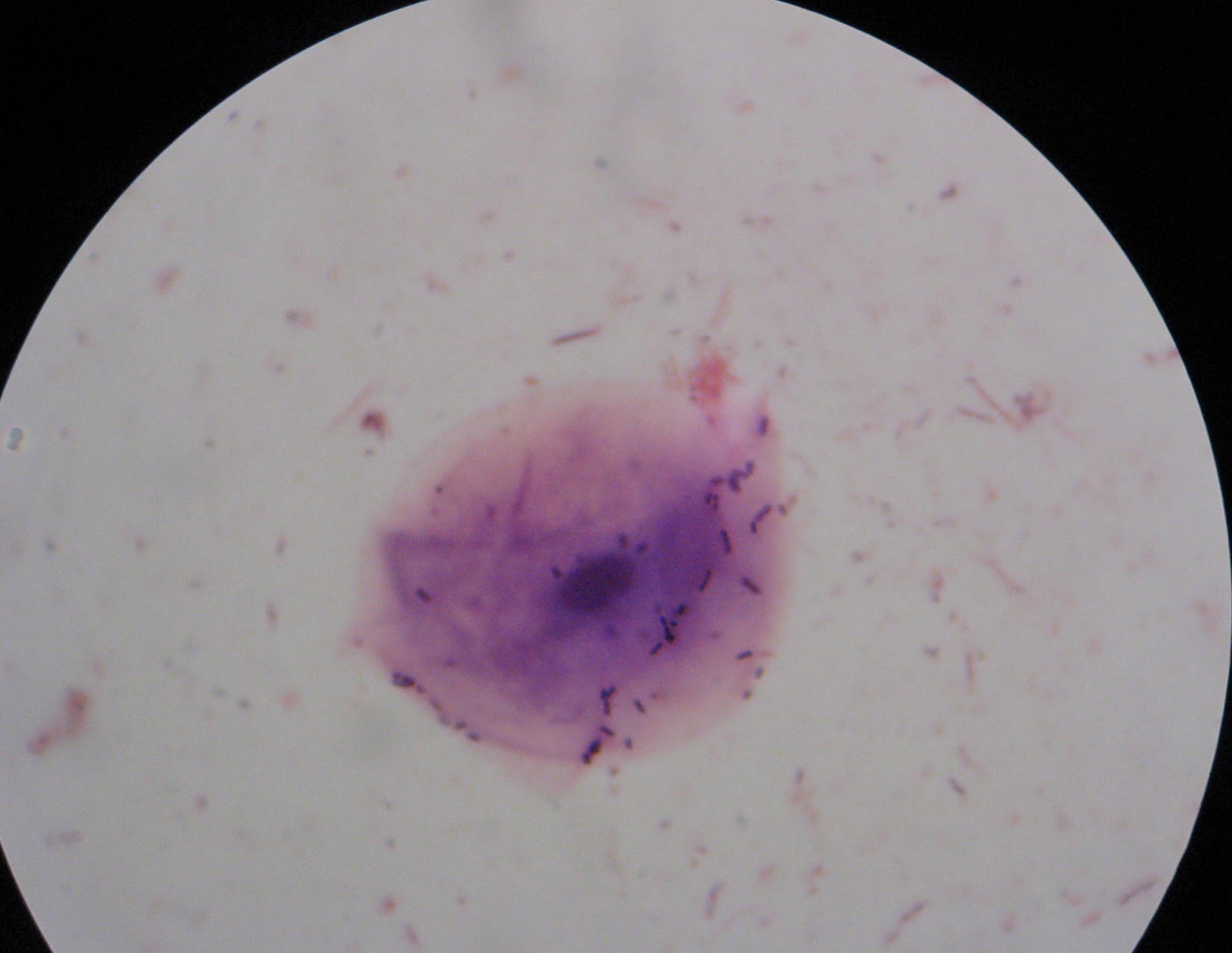 DVC Microbiology 146 Fall 11 (Gard): Lab 35: Oral Microbiota