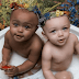 Beautiful Pictures Of The First Twin Sisters With Different Skin Colors Who Are 18 Years Old Today
