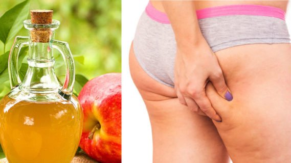 To Get Rid Of Cellulite
