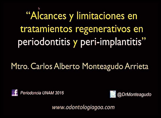 PERIODONCIA: Alcances y limitaciones de tratamientos regenerativos en Periodontitis y Periimplantitis - Videoconferencia del Mtro. Carlos A. Monteagudo