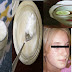 Home-Made Lotion That Can Make Dark spot And Acne Disappears In No Time