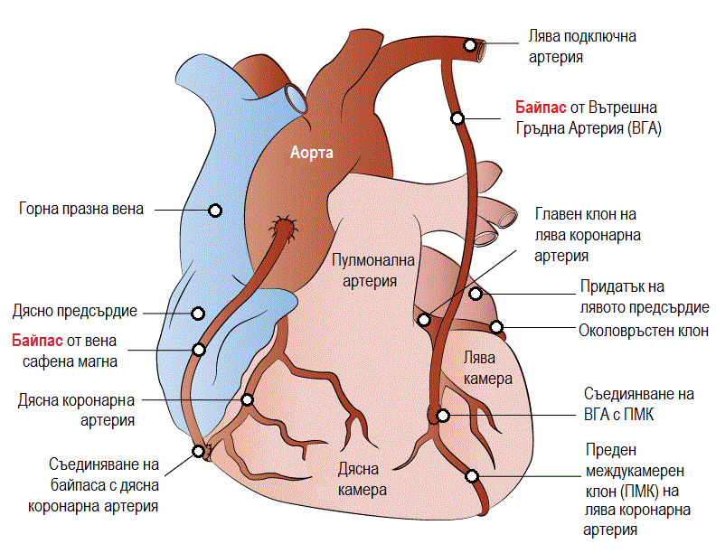 Сърце - коронарни артерии и байпас