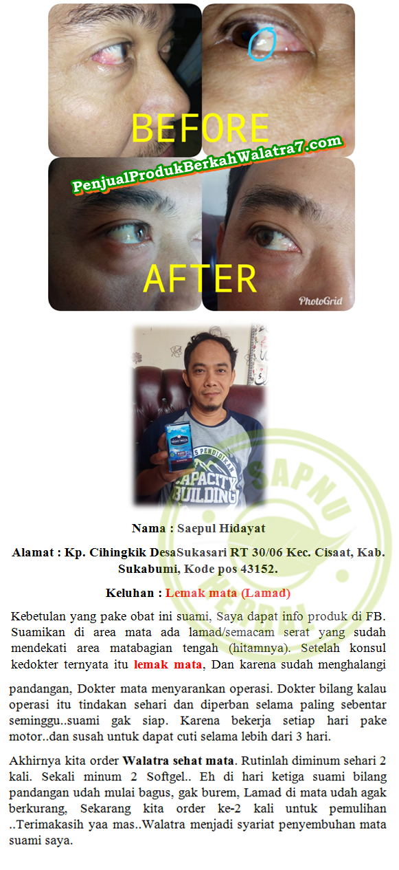 Cara Memutihkan Bola Mata Secara Alami Terbukti Mujarab ~ TESTIMONI PRODUK SEHAT MATA SOFTGEL Cara Memutihkan Bola Mata Secara Alami Terbukti Mujarab ~ TESTIMONI PRODUK SEHAT MATA SOFTGEL