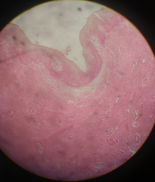 histology slide of vagina