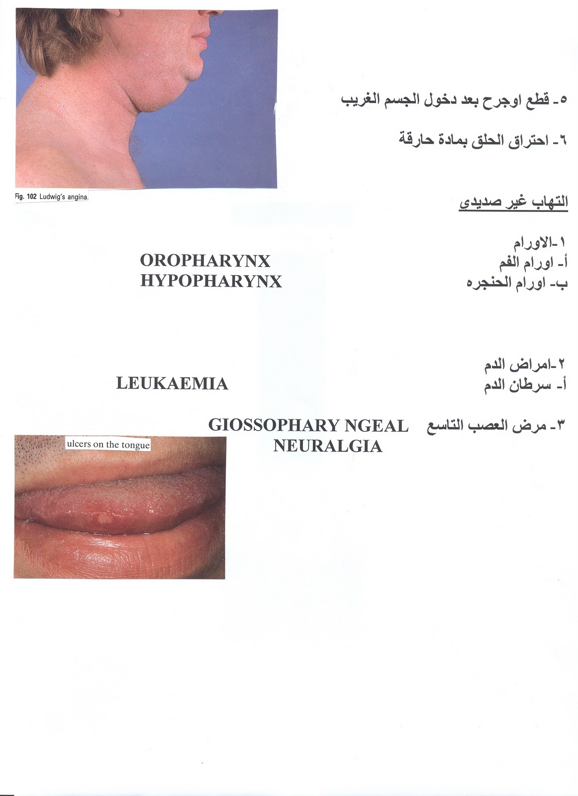 gonorrhea symptoms sore throat gonorrhea symptoms sore throat