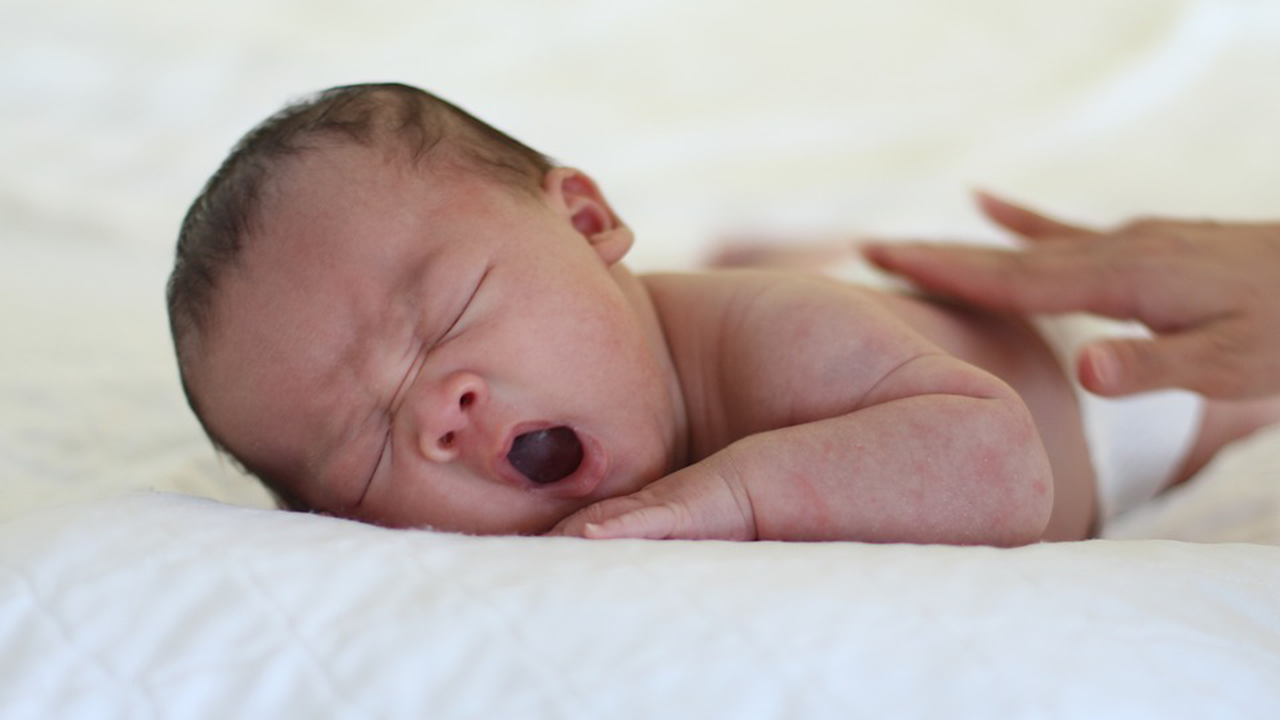 Perawatan Bayi Baru Lahir | Bayi Kuning