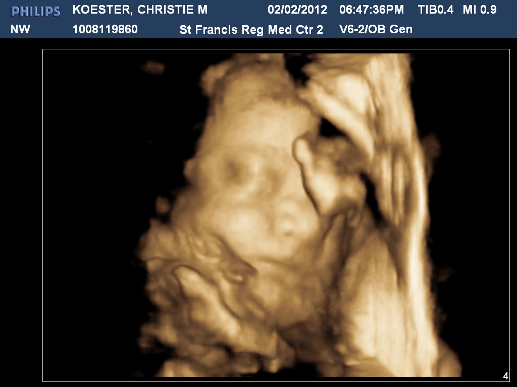 3D Ultrasound at 29 Weeks - Month 7 ~ Christie Koester