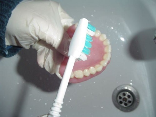 SO SÁNH PHƯƠNG PHÁP CẤY GHÉP IMPLANT VÀ HÀM THÁO LẮP SO SÁNH PHƯƠNG PHÁP CẤY GHÉP IMPLANT VÀ HÀM THÁO LẮP