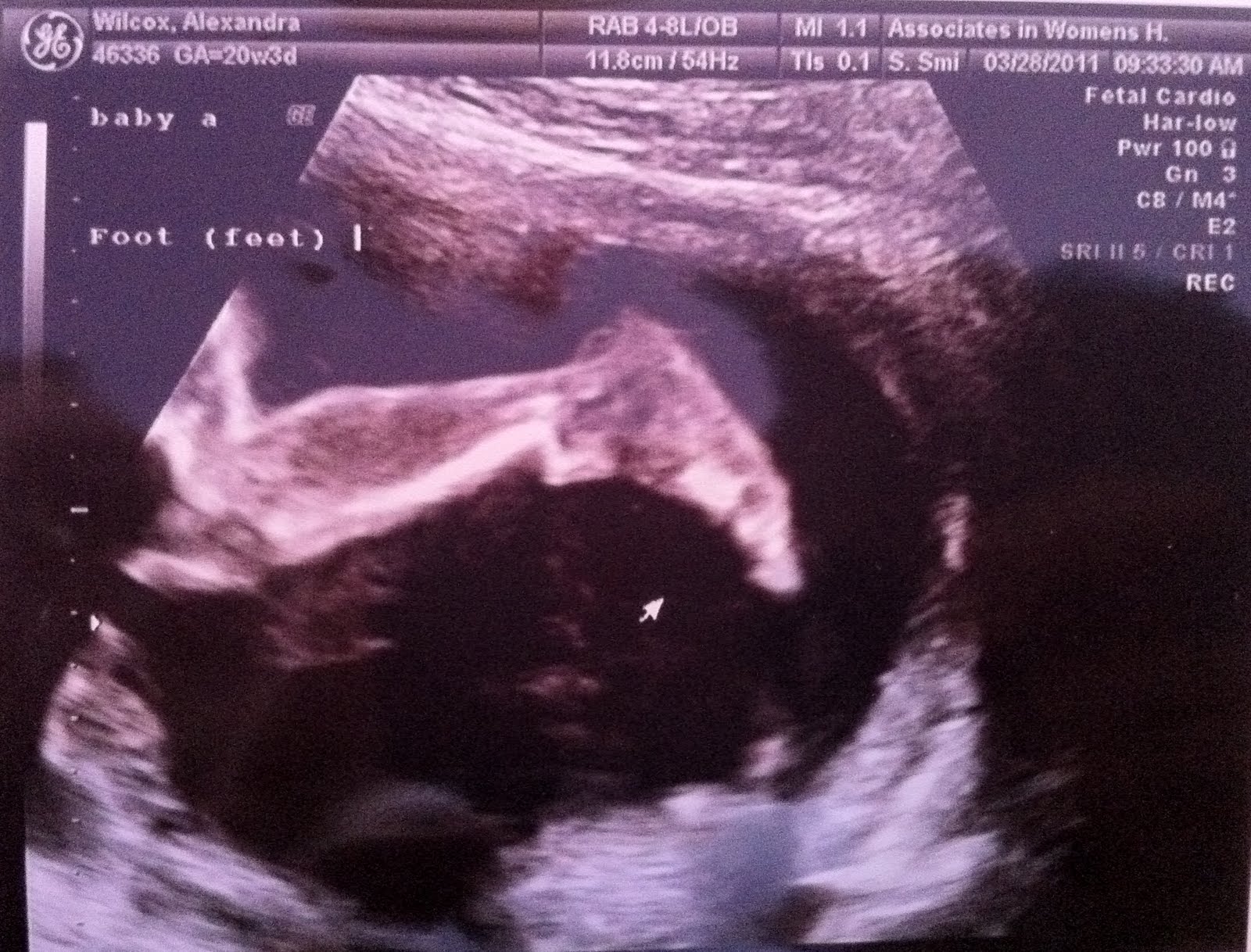 Baby Wilcox #2.... and #3: 20 week appointment/ ultrasound