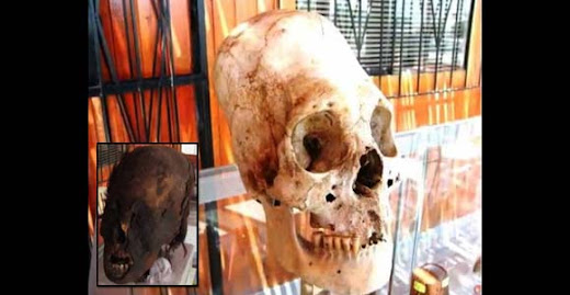 Cráneos de humanos híbridos con forma cónica de Paracas, Perú