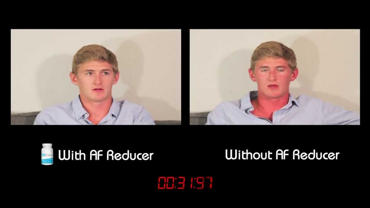 Alcohol flush reaction