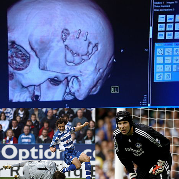 ÙÙØ§Ø°Ø§ ÙØ±ØªØ¯Ù Ø§ÙØ­Ø§Ø±Ø³ Ø¨ÙØªØ± ØªØ´ÙÙ Ø®ÙØ°Ø© ÙÙ Ø§ÙÙØ¨Ø§Ø±ÙØ§Øª ÙÙÙ ÙÙÙÙÙ Ø§ÙÙØ¹Ø¨ Ø¨Ø¯ÙÙÙØ§ ØºØ±ÙØ¨Ø©