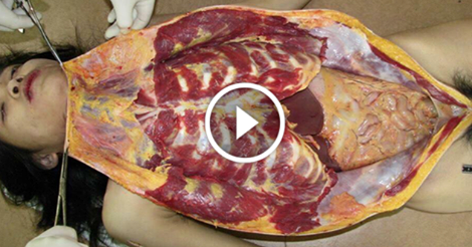 Postmortem videos of female dead bodies | Bollywood-Love Quotes