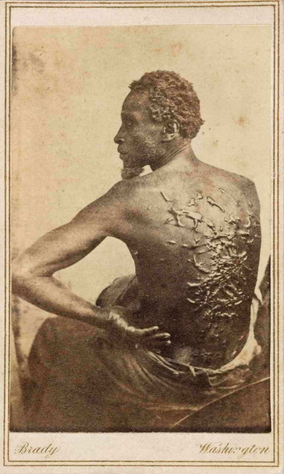 A Rolling Crone: The Scarred Back of a Slave Named Gordon