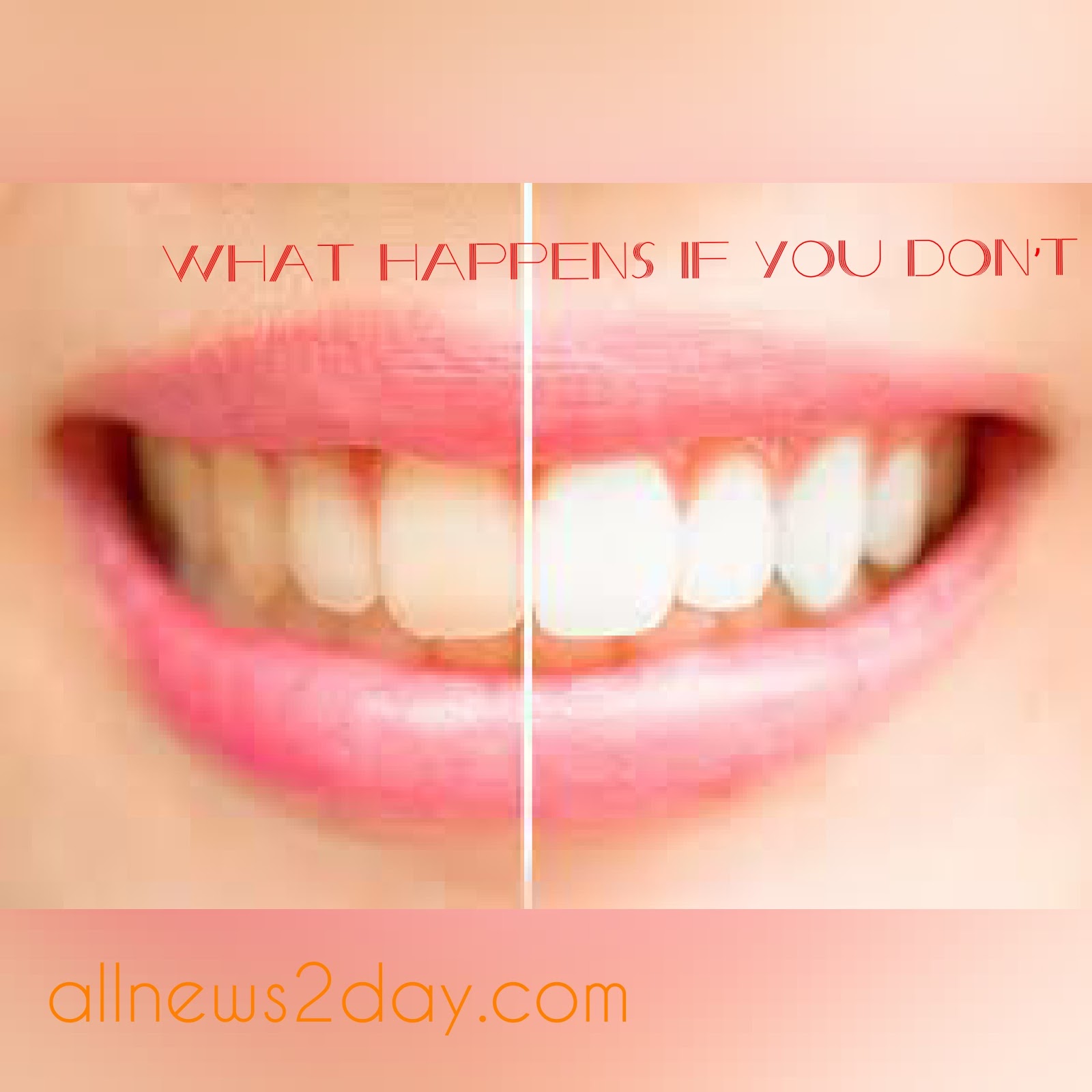 What Happens If You Don’t Brush Your Teeth? allnews