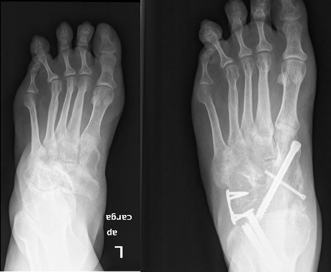 Fanáticos del pie ATLAS DE PATOLOGIA DEL PIE MULLER WEISS