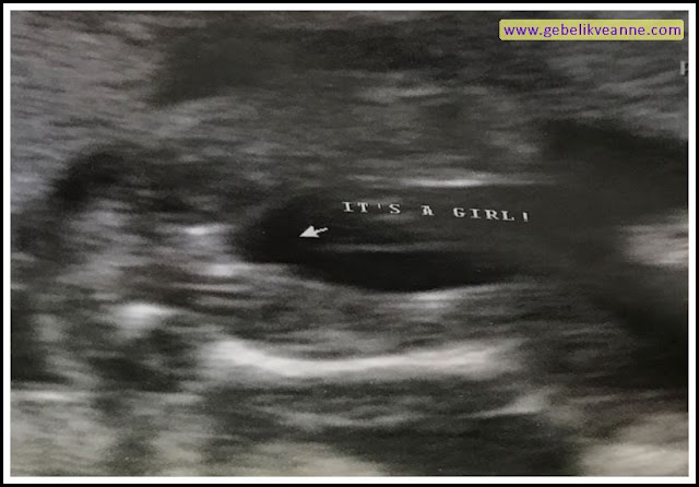 20 haftalık gebelik (hamilelik) görüntüsü