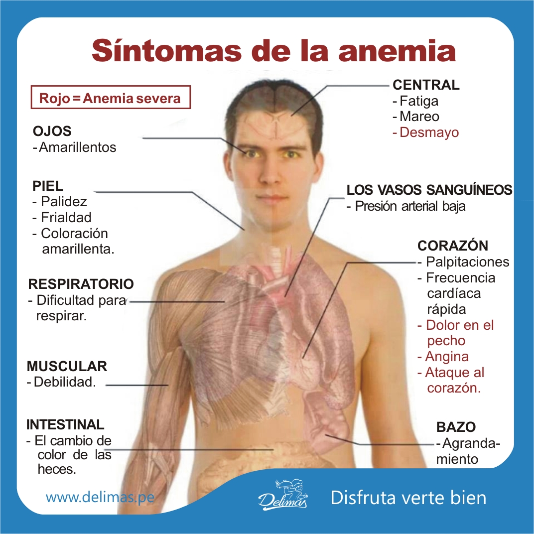 Apuntes médicos a la mano. síntomas de la anemia