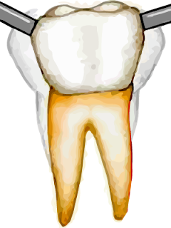 Loose teeth or loose tooth