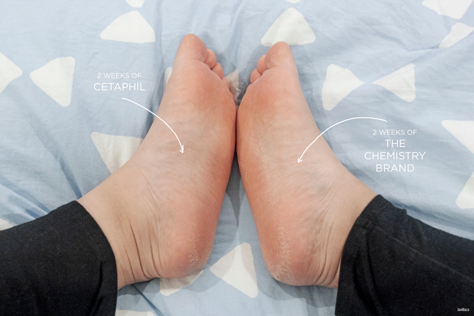 lavlilacs The Chemistry Brand Heel Chemistry comparison
