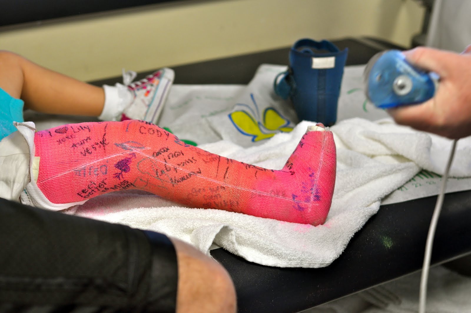 My Crazy Everyday Life that I Love Broken leg...what broken leg?