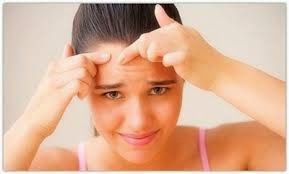 Healthy Tips to Remove Pimple and Acne 