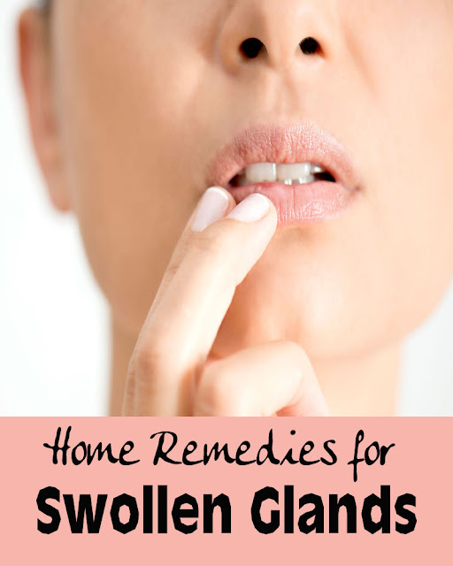 Home Remedies for Swollen Glands Healthy Sip