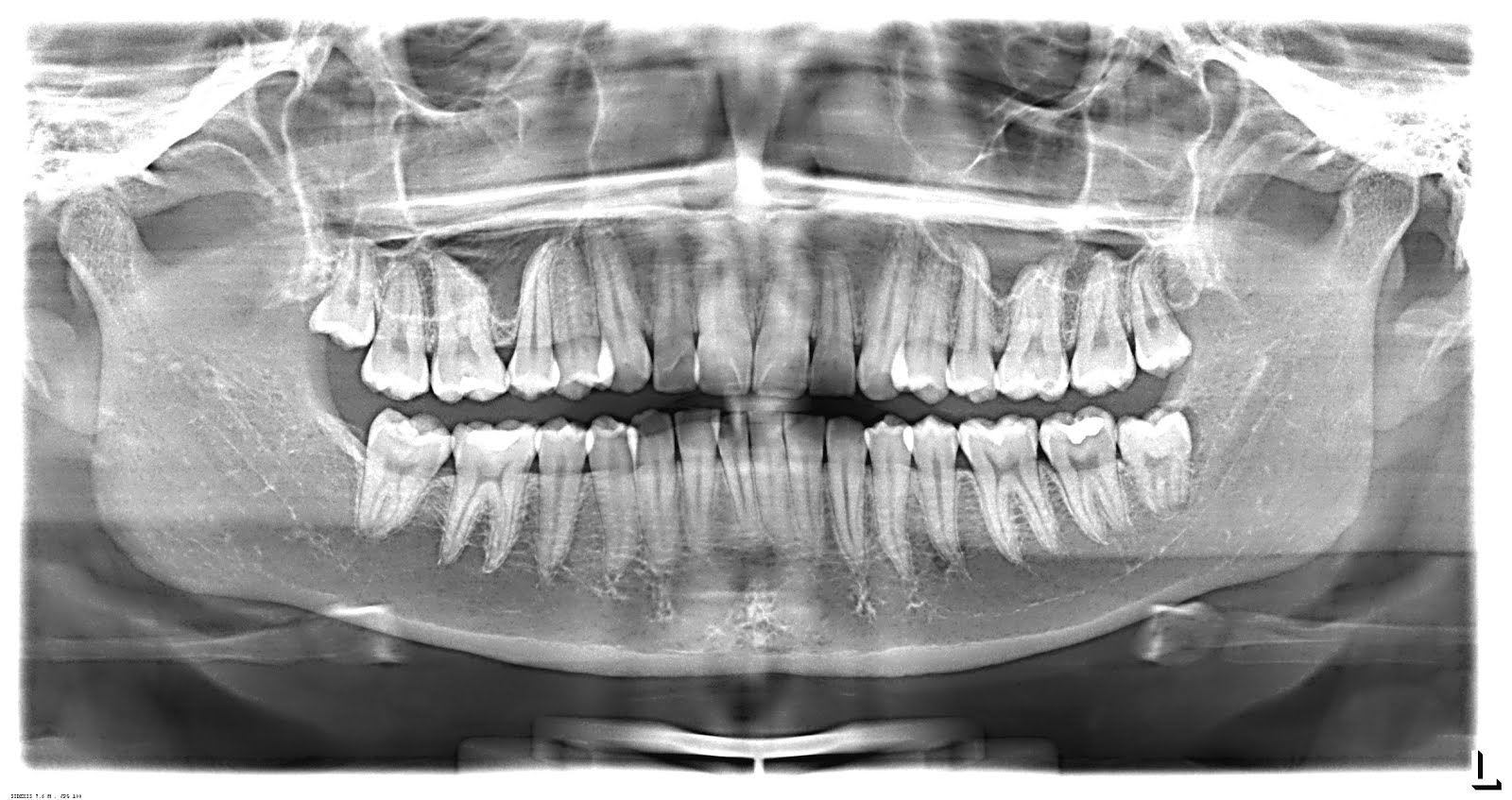 RADIOGRAFÍAS DENTALES MEDICAL DENTIX S.A.C.