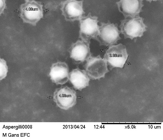 Scanning Electron Microscope Blog: Fungi - Images for Eastfield College ...